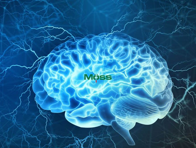 Liên hệ giữa suy yếu chuyển hóa năng lượng não và cơn mê sảng