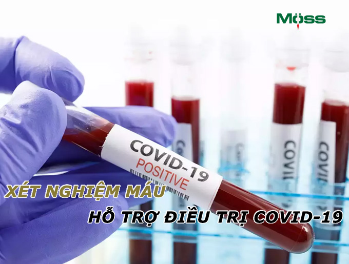 xet-nghiem-mau-ho-tro-dieu-tri-covid-19-tech-moss.jpg